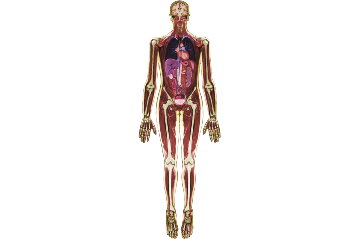 MRI-scan lichaam