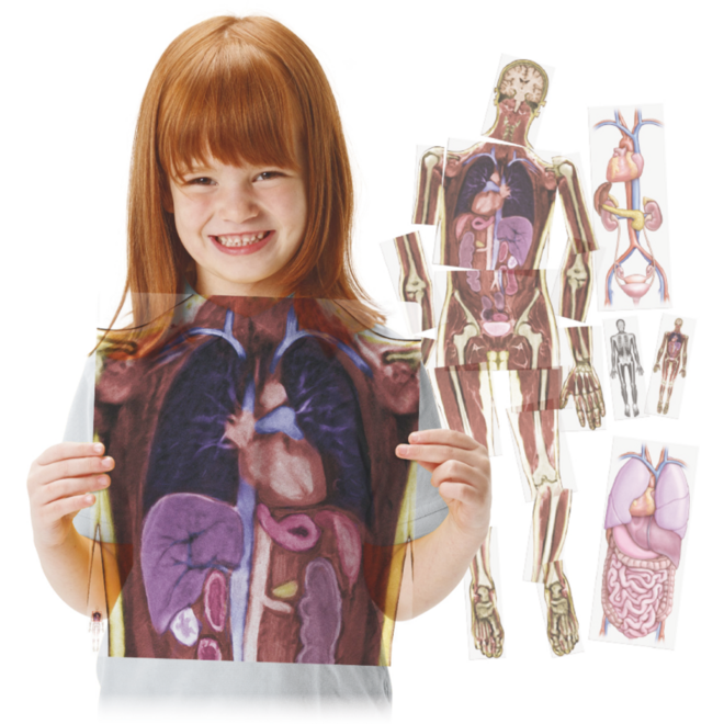 MRI-scan lichaam